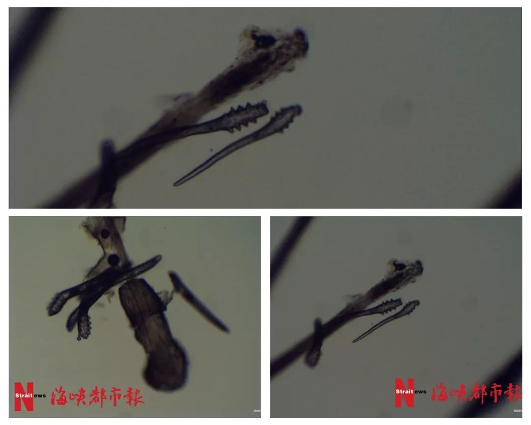 (老陈的睫毛,眉毛还有鼻部皮肤的螨虫)