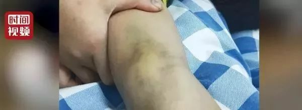 
14岁初二男孩被同学殴打致死：校园暴力何时了？未成年人保护法今年有望大修


