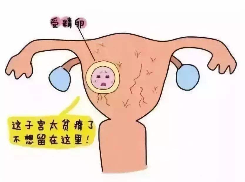 试管移植前子宫内膜息肉是否要切除_炎症