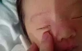                     宝宝眼屎多，家长处理不当险失明！眼屎多竟然也是病？