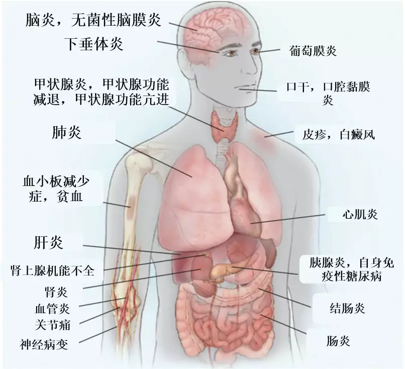 483dd8c1da6647c790a038fe0ea90e85.jpg
