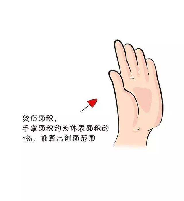                     原创            宝宝在户外烫伤后，爸妈该做和不该做的几件事