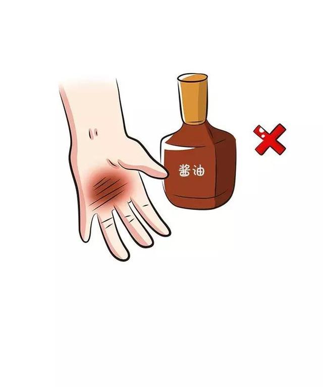                     原创            宝宝在户外烫伤后，爸妈该做和不该做的几件事