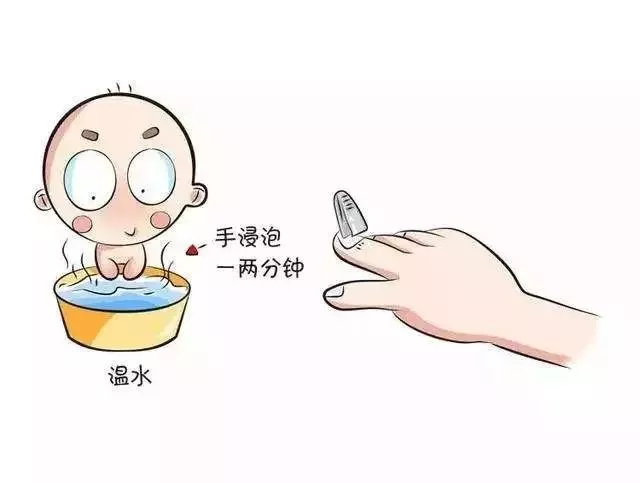                    手撕倒刺可能会出现脓毒症或败血症，甚至可能面临截肢？