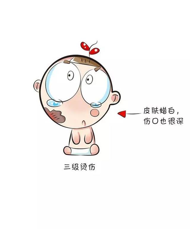                     原创            宝宝在户外烫伤后，爸妈该做和不该做的几件事