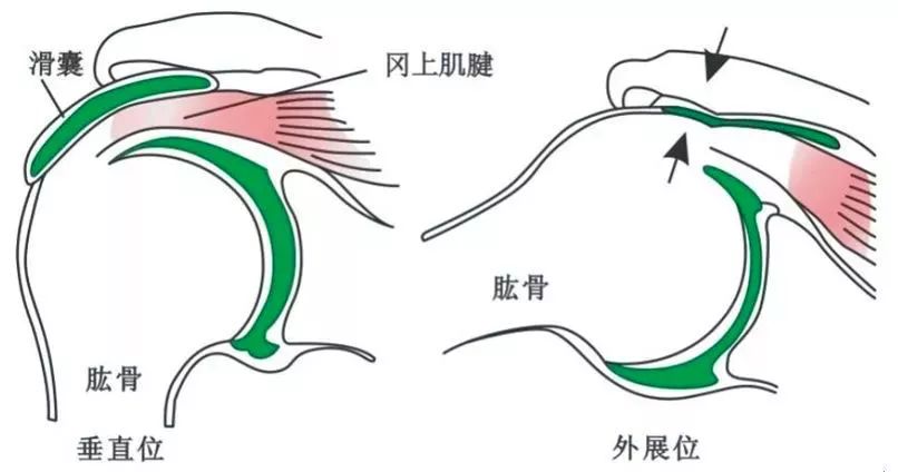 什么是滑膜炎 0fbb10efa7b94ff09e8d8969e5284206.jpeg