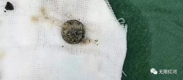                     喝了爸爸的一碗粥，东莞两岁娃竟发烧呕吐不止！检查一看……