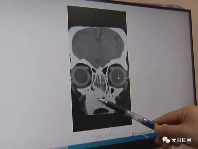                     喝了爸爸的一碗粥，东莞两岁娃竟发烧呕吐不止！检查一看……