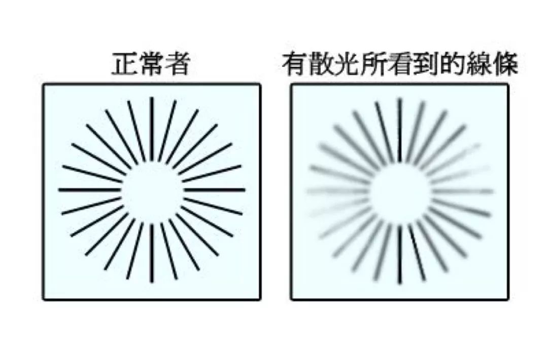 相比于正常视力者,景物在散光患者眼睛里成像时,一部分地区方清晰,一