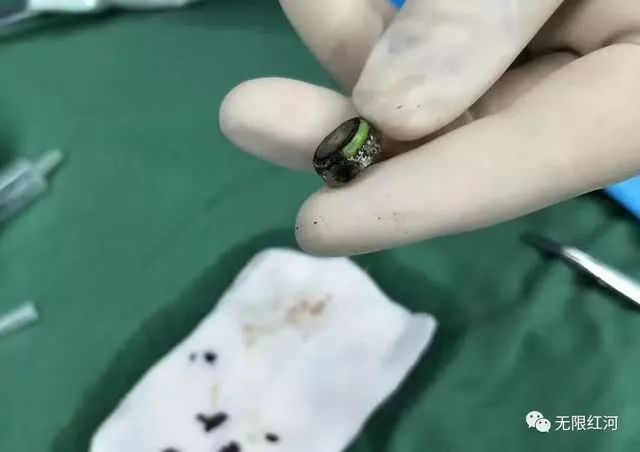                     喝了爸爸的一碗粥，东莞两岁娃竟发烧呕吐不止！检查一看……