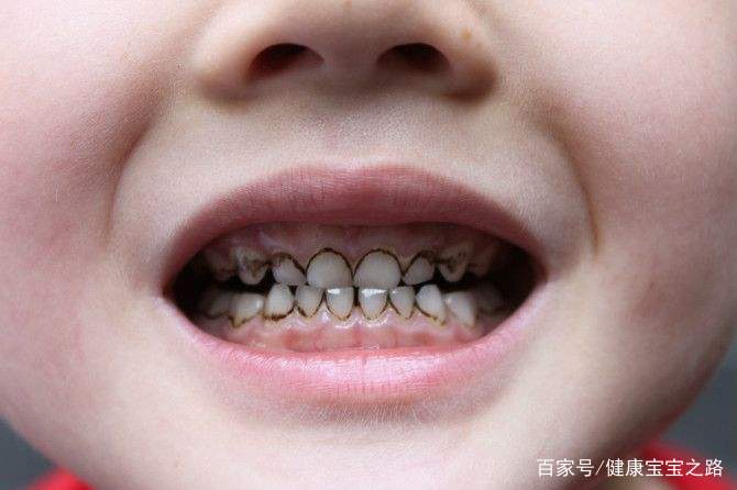                     儿科医生：这种饮料已上黑名单，孩子发育慢，没买过的家长真明智