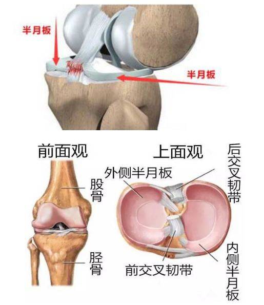 骨科知识科普你的膝关节弹响很可能是半月板损伤