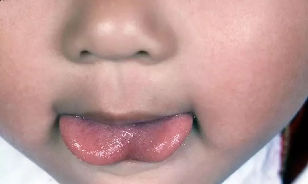 2,听宝宝 吮吸时,是否会发出 "嗒嗒"的弹舌音 3,宝宝吃奶后,乳头是否