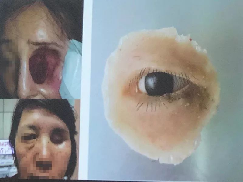 微记录我用3d技术打印了一只耳朵