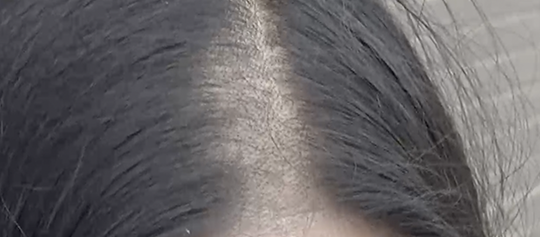 怎么在三天内长头发 9bb2c4e84e9a4792940a808877da73e2.png