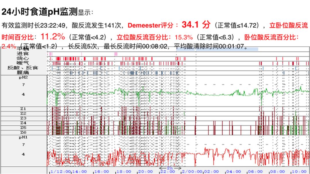 经胃镜检查,食管动态造影和高分辨率食管测压和24小时食管ph阻抗监测