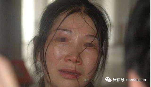                     四维能看到胎记吗？医生的解答出乎意料，如何预防胎儿长胎记？