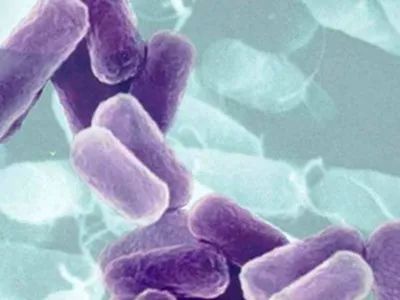 什么叫垂直传播 bce438d3eecb4763b2d904246cb93c49.jpeg