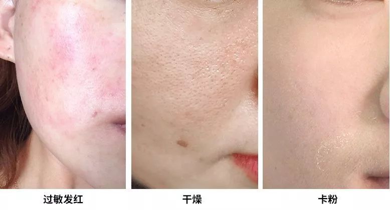 今年最有料的国潮精油皂出现了,好用到停不下来_皮肤