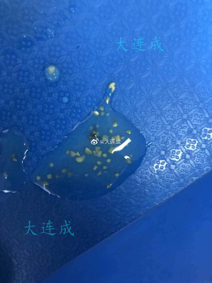 
卫生堪忧！大连艺术学院学生在食堂竟吃出虫子“一家三口”


