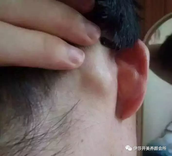 怎么做淋巴疏通 14cc7f092f7e447b960b3f8328d987a0.jpeg