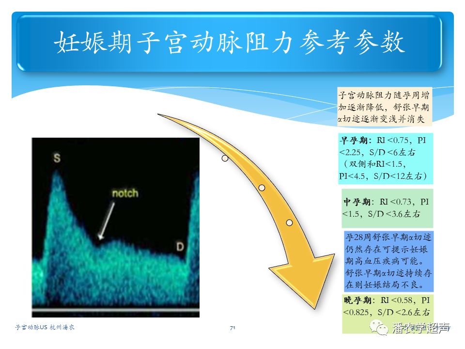 子宫动脉超声检查