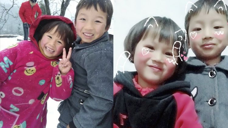                     4岁女童全身严重烧伤，崩溃痛哭：“哥哥为什么要拿火烧我”