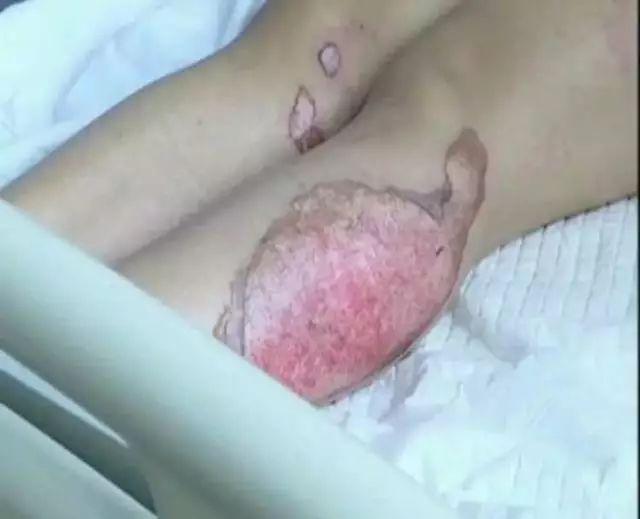                     2死12伤，游乐场没有这种标识，千万别让孩子玩