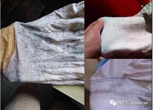 轻松洗掉衣服上的霉点 日博官网
