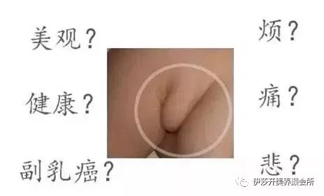 什么是人体最大的淋巴器官 62b1ca210c6d441a8019fe72cda8243b.jpeg