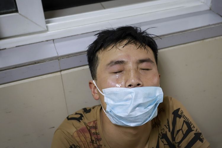                     4岁女童全身严重烧伤，崩溃痛哭：“哥哥为什么要拿火烧我”