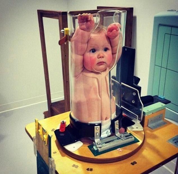                     幼儿被放入“O型小猪笼”X光固定器笑翻网友