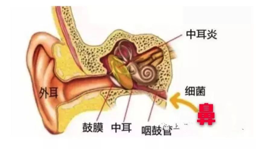 造成咽鼓管堵塞,反而以"分泌性中耳炎"为首发症状