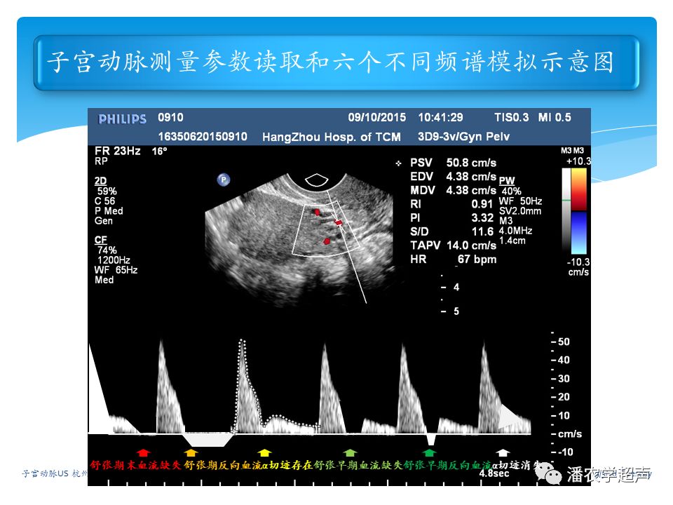 子宫动脉超声检查