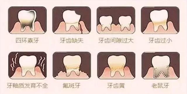 人口多少牙齿_蜗牛有多少颗牙齿图片