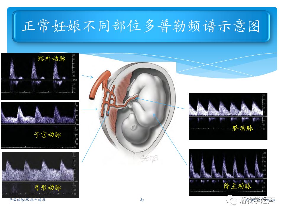 子宫动脉超声检查