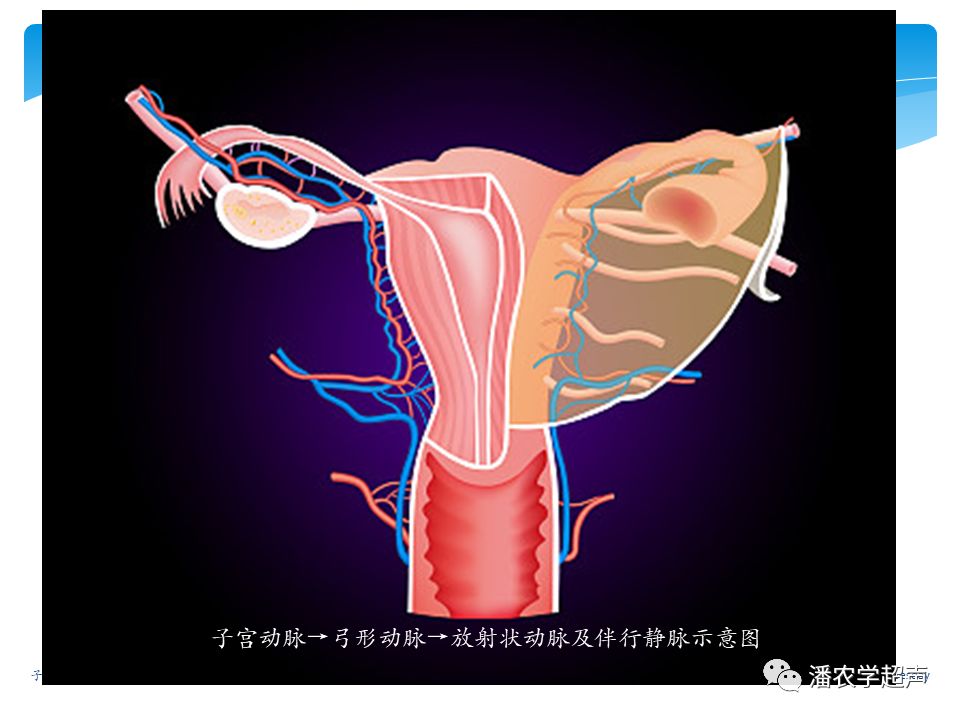 子宫动脉超声检查