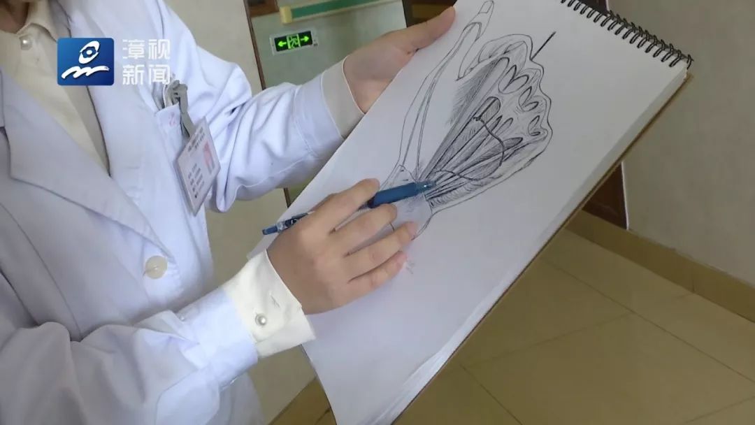 每个医生写的病历都自成一派 今天小编要说的 是"绘画派病历" ▽ 下面
