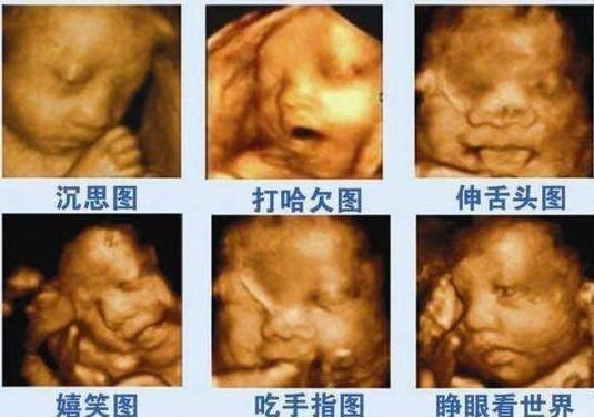 cdc5cc5a6cb64b3cb874993a74b8d74c.jpeg