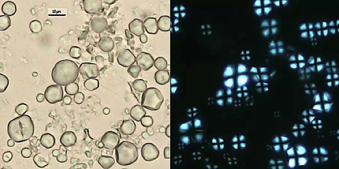 小麦显微镜下的淀粉粒形貌(左边为显微镜正常光下图像,右边为偏光