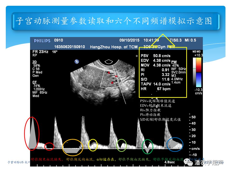 子宫动脉超声检查