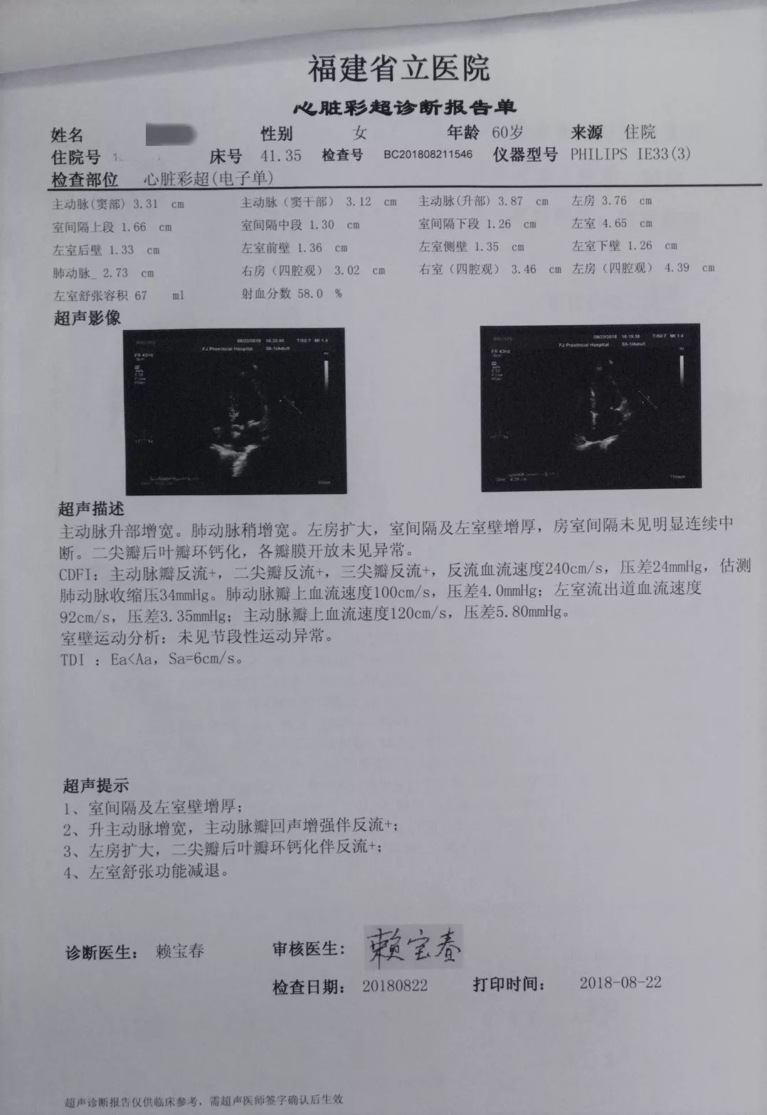 重庆离婚律师 > 正文   2010彩色心脏超声 胸腹主动脉cta:胸腹主动脉