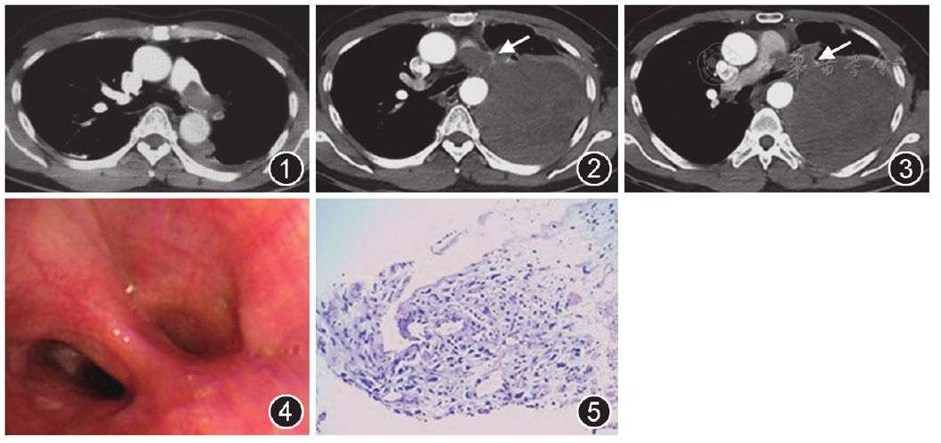 什么是动脉血管造影 2223b0f3fefe40758f04a792648830e5.jpeg