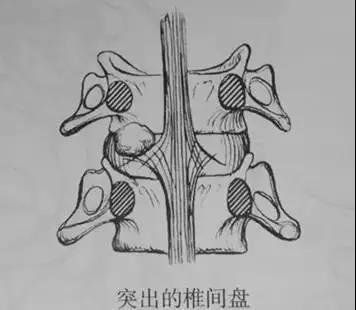 成语什么剌骨_成语故事图片(3)