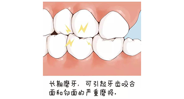 睡觉磨牙怎么办?