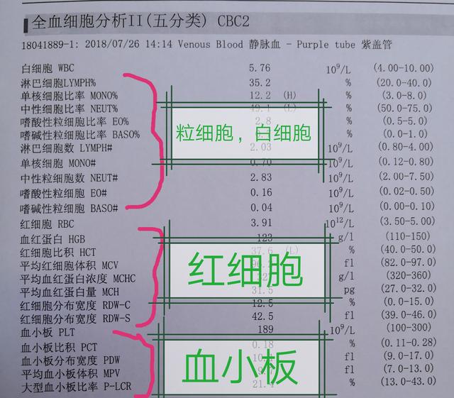 “血常规”，可能提示这些疾病！医生手把手教你怎么看 化验