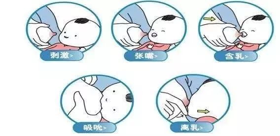 乳头皲裂怎么办