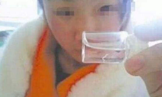                     2岁女童不停用手揉眼睛，医生检查结果，把父母吓坏了！