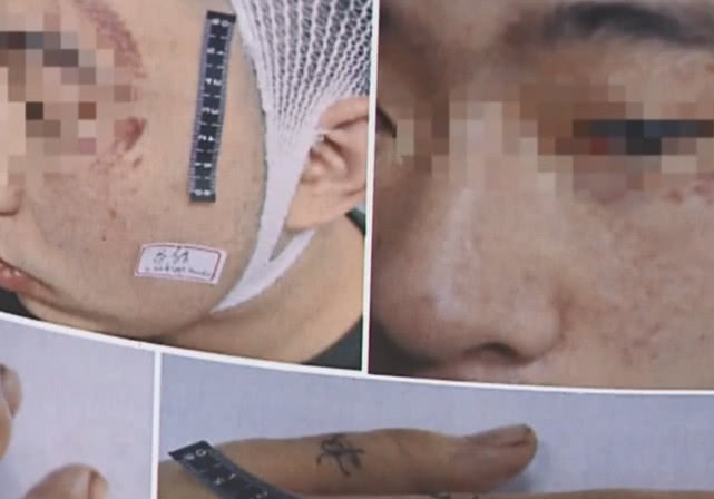 男子吃火锅被误认是服务生,聚9人怒殴:我女朋友听见不开心! 赌博技巧网站