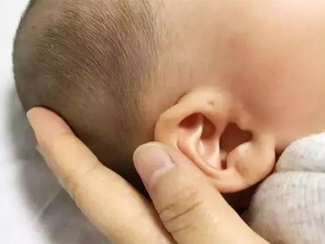                     孩子的耳朵天生就有小孔，是“福气”？父母别忽略，要重视